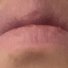 so?