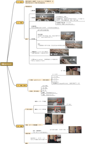 脊髓(spinal cord)解剖