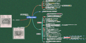无牙颌解剖标志及临床意义