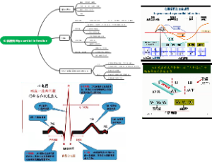 ECG心肌梗死Myocardial infarction