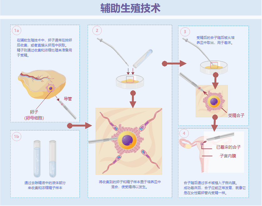 辅助生殖技术全流程详解：试管婴儿技术与胚胎着床机制模板