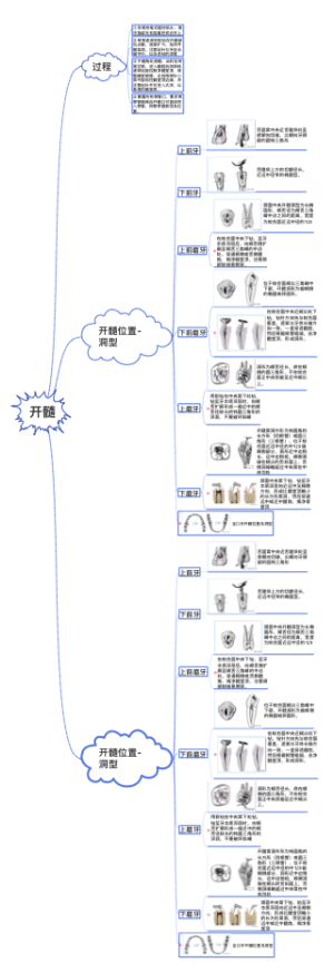 根管治疗开髓