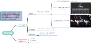 肥厚型心肌病超声