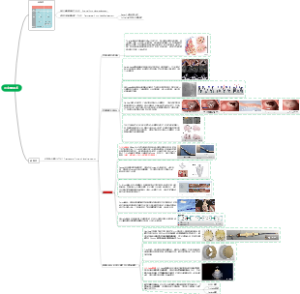 三尖瓣介入手术