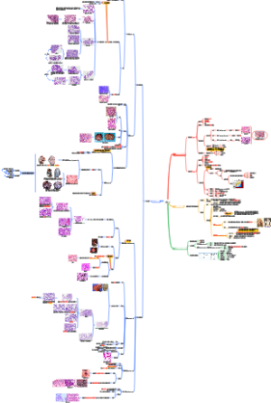 病理学——肿瘤 Ⅱ