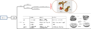 胆石症概述
